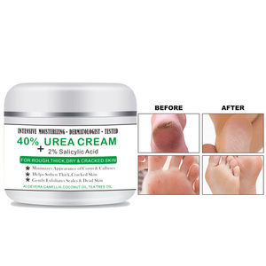 Crema Anti-asciugatura per Crack e piedi pelle morta per la cura dei piedi 100g di crema 40% Urea riparatrice con crepnel tacco - Product Image 4