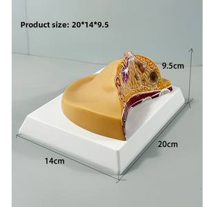 Modelos de Patología de Lesiones Mamarias y Lobos de Conductos Mamarios Anatómicos Humanos MAC-YJ57 PVC MAXCARE - Product Image 2