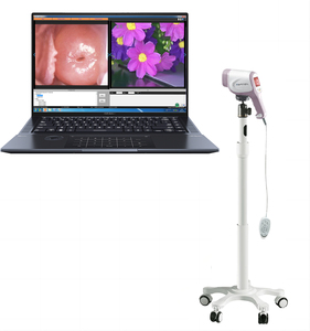 Colposcope vidéo optique HD médical 20204 pour l'examen gynécologique du vagin - Product Image 2