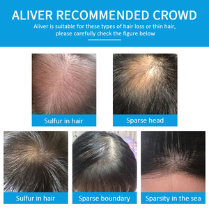ALIVER Etichetta Privata all'Ingrosso per Sfumare Invisibilmente con i Tuoi Capelli Esistenti e Rendere Istantaneamente IT Capelli Più Folti e Voluminosi - Product Image 4
