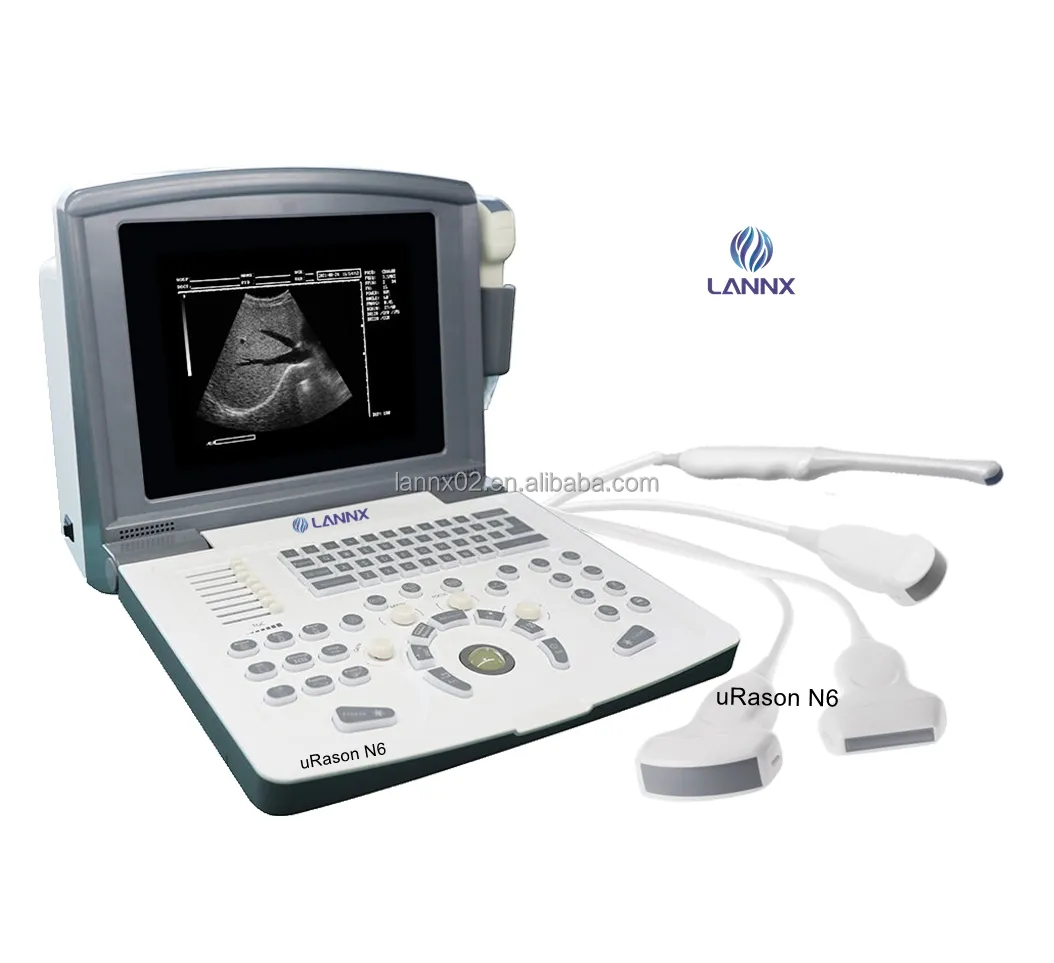 LANNX uRason N6 Instruments à ultrasons médicaux ecografia portatil Portable 2D échographie électrique noir et blanc