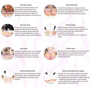Traitement des cicatrices d'acné, des rides et des grains de beauté, Jet d'ozone, Hyper Scalp, Lifting des paupières, Chaud et Froid - Product Image 2