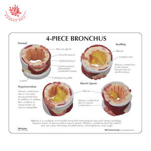 4-delige Brounchus Model Normale Zwelling Hypersecretie Spierspasmen Anatomisch Model - Product Image 5
