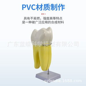 Modelo de diente humano ampliado 12 veces con molde desmontable para la anatomía del diente, pulpa, nervio, incisivos, caninos y molares. - Product Image 1