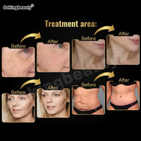 Máquina de Modelado Corporal con Pantalla Táctil de 10.4 Pulgadas ODM OEM, Máquina de Reducción de Celulitis 7dH1fu para Spa de Belleza