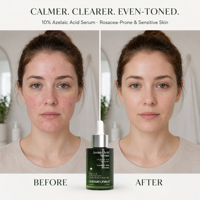 Sérum à l'acide azélaïque 10% en marque propre avec extraits de Centella et vitamine E, traitement anti-acné réducteur de pores