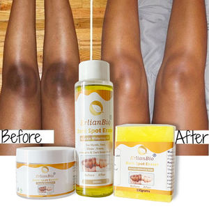 Etiqueta privada Cuerpo Nudillos Productos para blanquear las axilas Aclarar la melanina Vitamina C Brillo e hidratante Conjunto para el cuidado de la piel - Product Image 2