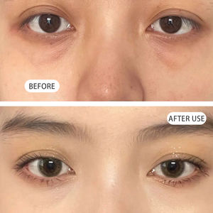 Crema de ojos con retinol para reducir arrugas, reafirmante, hidratante y que mejora las ojeras. - Product Image 4