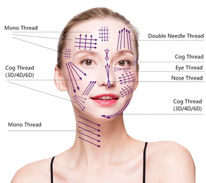 En kaliteli kore cerrahi sütür iplik PLLA/PCL/PDO COG güzellik pdo kaldırma konuları hilos - Product Image 3