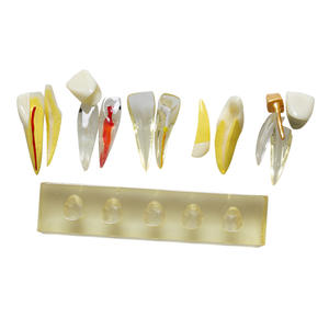 Modelo de Pulpa Dental Anterior con Pulpitis, Modelo de Enseñanza Dental Clínico Patológico, Equipo y Accesorios - Product Image 3