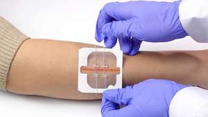 Dispositivo Transparente de Fechamento de Feridas com Zíper, Sem Dor, com Agulhas de Sutura, Redutor de Feridas, Adesivos de Ajuda para Sutura com Zíper - Product Image 6