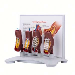 Modelo de <span class=keywords><strong>stent</strong></span> vascular humano KyrenMed, soporte de bloqueo de vasos sanguíneos cardiovasculares de arteria coronaria, modelo de bloqueo de vasos sanguíneos - Product Image 2
