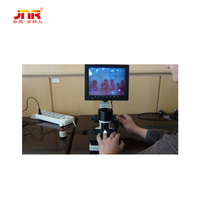 High-Resolution Nailfold Microcirculation Microscope for Medical Diagnostics