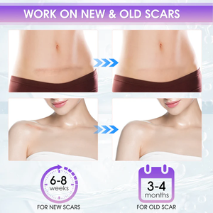 Private Label Geavanceerde Siliconen Littekengel Medische Kwaliteit Striae Brandt Keloïde Acne Littekens Verwijderaar <span class=keywords><strong>Gel</strong></span> Voor Oude En Nieuwe Littekens - Product Image 3