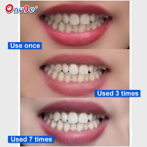 Tiras blanqueadoras de dientes naturales sin Peróxido de muestra gratis, tira de acción rápida para blanquear los dientes - Product Image 3