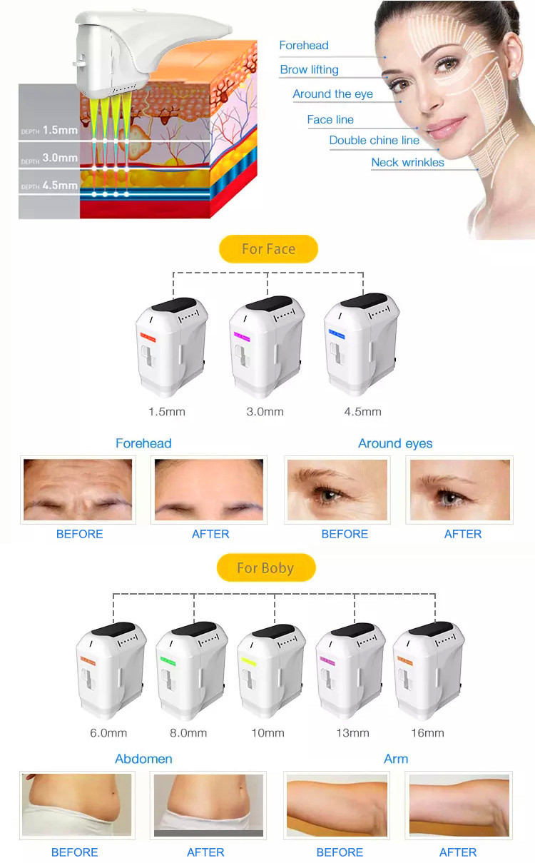 4D 60000 Shots 11 Lines Anti Wrinkle Face Lift Skin Tightening Body Slimming 3D 4D beauty machine