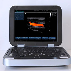 Échographe <span class=keywords><strong>Doppler</strong></span> Couleur Portable pour Vétérinaires MT MEDICAL – <span class=keywords><strong>Prix</strong></span> Usine – Scanner Échographique Vétérinaire Entièrement Numérique 32 Canaux - Product Image 2
