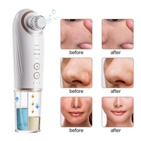 Limpiador de Poros Eléctrico Recargable por USB, Herramienta para Eliminar Puntos Negros, Extractor de Comedones, 4 Cabezales, Spa Facial en Casa, Terapia Fría/Caliente
