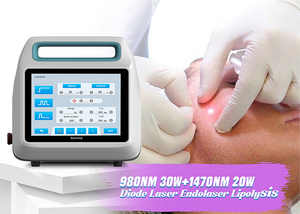 Instrumen Bedah Laser untuk Pengobatan Wasir, Fistula, dan Sinus Pilonidal dengan Laser Diode 1470nm dan 980nm - Product Image 6