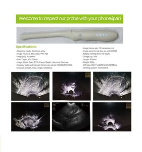 <span class=keywords><strong>Sonde</strong></span> linéaire rectale portative sans fil à ultrasons B, avec matrice convexe/ligne linéaire, pour la mesure de la gestation vétérinaire transrectale - Product Image 4