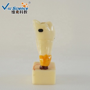 Modelo de Dentes Humanos em Quatro Vezes para Doenças Periodontais, Modelo Educacional em Ciências Médicas - Product Image 4