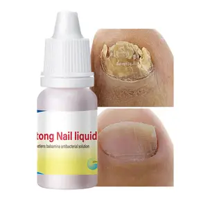 Набор для ухода за онихомикозом 980 Лечение грибка ногтей для пальцев и ногтей от грибковых инфекций #1 Натуральное лечение