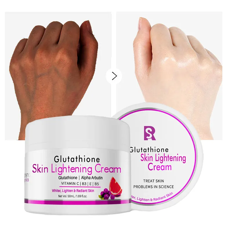 Supporto personalizzato Gluta White Cream crema sbiancante schiarente per la pelle e il viso per il commercio all'ingrosso