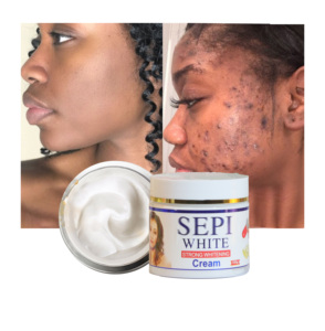 Nhãn hiệu riêng sepi mạnh mẽ làm trắng, chống mụn và giữ ẩm 100g Kem Mặt Kem - Product Image 1