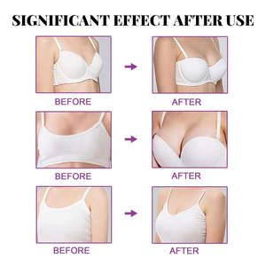 Gomitas de Apoyo Mamario Más Vendidas OEM con Biotina, Queratina y Colágeno para Adultos - Efecto Natural de Levantamiento y Firmeza - 60 Piezas por Botella - No apto para - Product Image 5