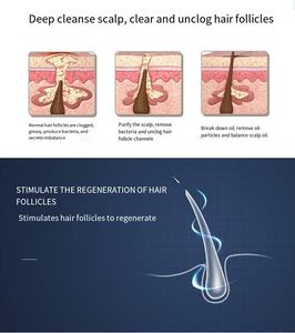 Mesin Perawatan Rambut Multifungsi 5 in 1 untuk Mengatasi Kerontokan Rambut, Merangsang Pertumbuhan Rambut, Perawatan Kulit Kepala, Analisis Kulit Kepala, Terapi Cahaya untuk Klinik, Spa, dan Salon - Product Image 6