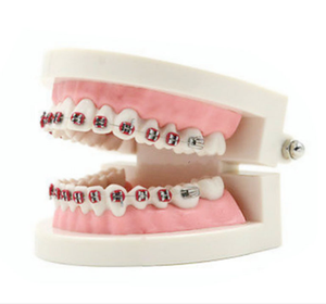 Modello Dentale Pediatrico <span class=keywords><strong>di</strong></span> Piccole Dimensioni per l'Insegnamento Odontoiatrico e l'Esposizione della Cura della Salute Orale, Modello per Trattamenti Ortodontici - Product Image 4