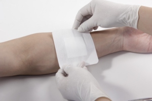 Dispositivo de cierre de piel de herida resistente a bacterias <span class=keywords><strong>con</strong></span> certificado CE médico desechable tiras transparentes sin costuras autoadhesivas estériles - Product Image 6