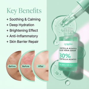 Suero Facial OEM de Centella Asiática y <span class=keywords><strong>Aloe</strong></span> <span class=keywords><strong>Vera</strong></span>, Calmante, Reparador, Hidratante, para Piel Sensible, Alivia el Enrojecimiento Facial - Product Image 3