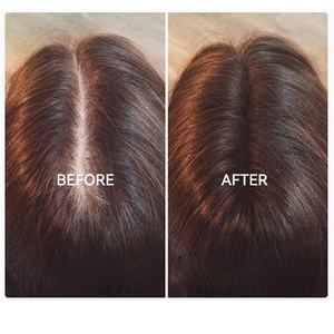 Suero de ampolla nutritiva para el crecimiento del cabello de 5ml para el cuero cabelludo - Product Image 6