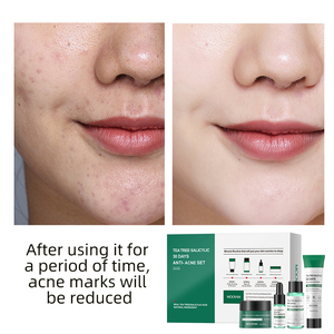 Etichetta privata Anti invecchiamento riparazione <span class=keywords><strong>Kit</strong></span> cura della pelle illuminante sbiancante Acne Tea Tree cura della pelle Set per le donne - Product Image 4
