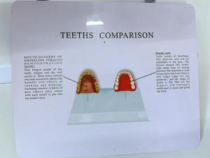 <span class=keywords><strong>Model</strong></span> pengajaran sains medis kedokteran gigi, sumber daya kesehatan manusia Oral dan merokok <span class=keywords><strong>Model</strong></span> Perbandingan mulut - Product Image 4
