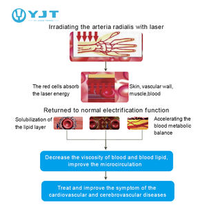 650nm LLLT Bio lazer diyabet tipi <span class=keywords><strong>2</strong></span> Tinnitus tedavisi lazer tedavisi düşük kan basıncı diyabetik soğuk lazer izle - Product Image 2
