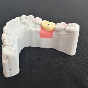 Produits d'implants dentaires laboratoire numérique personnalisé <span class=keywords><strong>molaire</strong></span> dent artificielle bonne marge meilleur ajustement <span class=keywords><strong>prix</strong></span> bon marché - Product Image 1