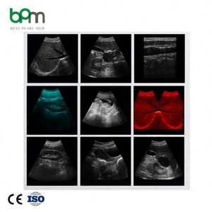 Pasokan pabrik emas mesin <span class=keywords><strong>Ultrasound</strong></span> manusia - Product Image 4