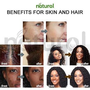 Aceite de Vitamina <span class=keywords><strong>E</strong></span> Personalizado, Aceite Esencial de Masaje con Vitamina C y Jojoba para Spa, Aceite Corporal Blanqueador, Hidratante Natural para la Piel - Product Image 3