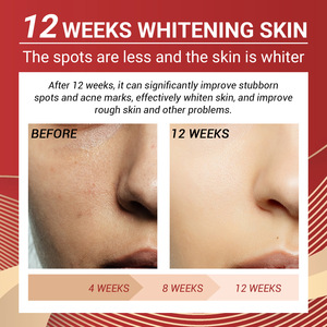 L'essenza abbellente della pelle di ciliegio a foglia d'ago illumina la pelle scura, idrata, ripara e idrata - Product Image 5