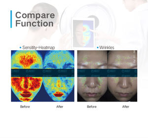 Máquina Facial 3D de Cinco Espectros de Luz, Espejo Mágico con WiFi, LED y Control por iPad para Análisis de Piel, Gran Venta - Product Image 3