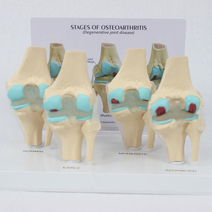 SCIEDU articulation du genou <span class=keywords><strong>squelette</strong></span> ressource pédagogique médical <span class=keywords><strong>humain</strong></span> 4 étapes modèle d'articulation du genou avec carte arrière modèle d'articulation du genou malade - Product Image 3