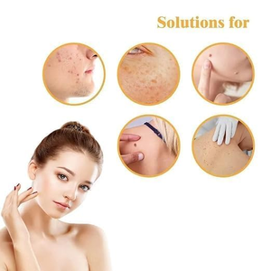 Patchs anti-acné hydrocolloïdes transparents invisibles à marque privée pour boutons et imperfections – Offre Spéciale - Product Image 3