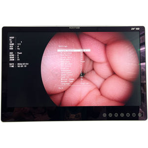 SY-PC047 अच्छी कीमत गैस्ट्रोस्कोपी कोलोनोस्कोपी एंडोस्कोपी कैमरा सिस्टम मेडिकल पोर्टेबल लैप्रोस्कोपी साइटोस्कोप - Product Image 2