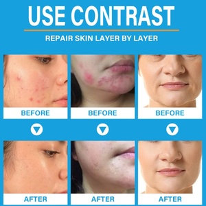 ครีมบำรุงผิวหน้าให้ความชุ่มชื้น/ขมิ้น/ชาเขียว/เปปไทด์/เรตินอล/24K/วิตามินซี/ไวท์เทนนิ่ง/หอยทาก/กุหลาบ/ยา/ครีมบำรุงผิวหน้า - Product Image 5