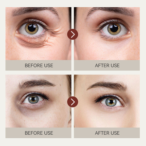 Crema de Ojos Herbal Orgánica con Retinol IREV OEM al por Mayor, Crema Antienvejecimiento que Ilumina los Ojos, Antiarrugas, Calma las Ojeras - Product Image 5