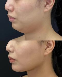 Siero Liquido Modellante per il Corpo 50ML |   Trattamento Rassodante e Tonificante per la Pelle - Product Image 2