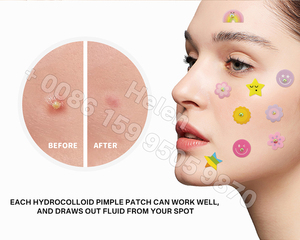 Parches de Hidrocoloide Personalizables de Venta Directa de Fábrica para Espinillas Faciales y Puntos de Acné con Estuche de Espejo - Product Image 2