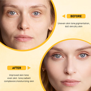 Giá Bán Buôn Hữu Cơ Thảo Dược Tự Nhiên Chống-Mụn Trứng Cá Làm Trắng Sáng Rắn Nghệ Kojic Axit Xà Phòng 100G 150G 200G - Product Image 3